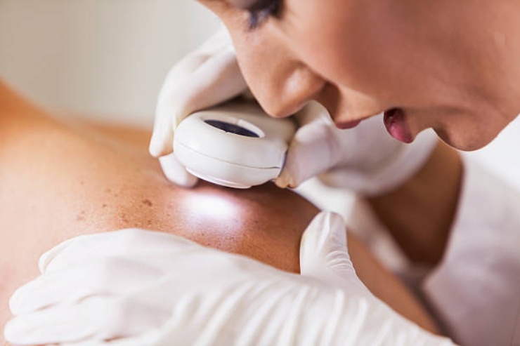 Dermatology-------15