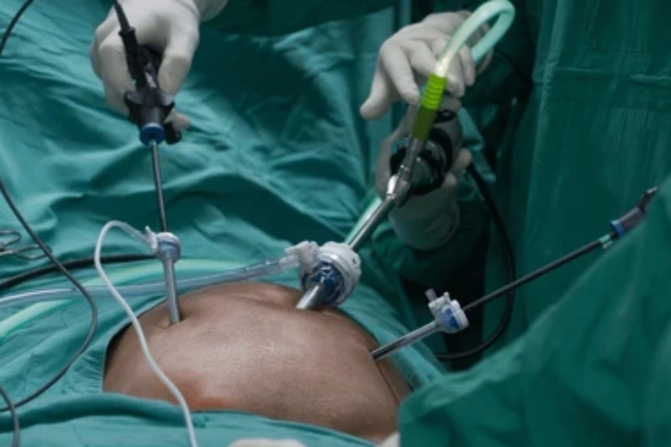 General & Laparoscopic Surgeries-----15
