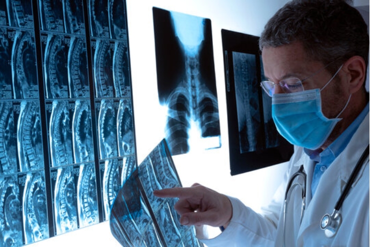 X-ray (24_7)-----15
